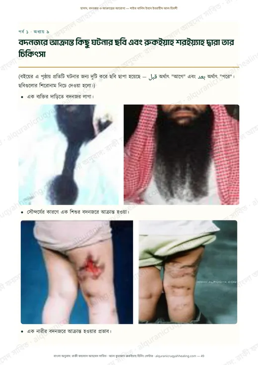বদনজরে আক্রান্ত কিছু ঘটনার ছবি এবং রুকইয়াহ শরইয়্যাহ দ্বারা তার চিকিৎসা